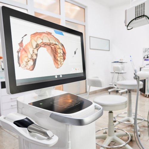 Escaner Intraoral iTero Scanner