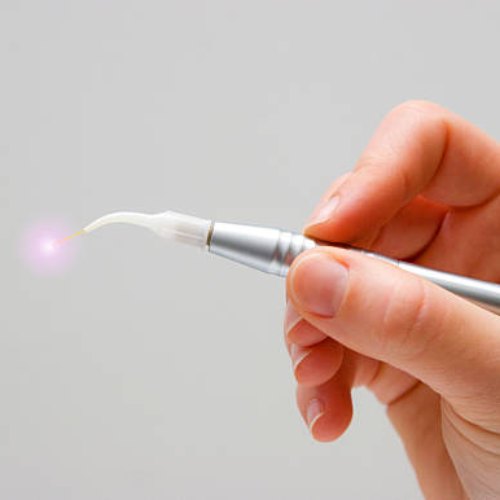 Laser Dental