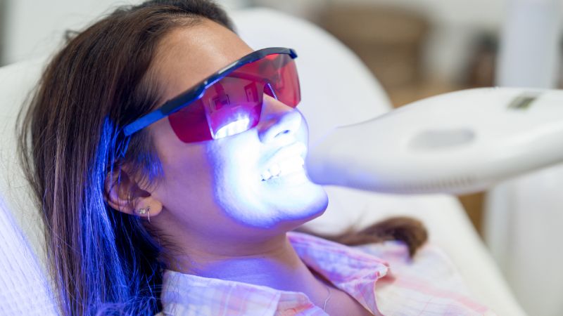 Blanqueamiento dental