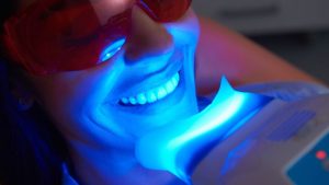 Blanqueamiento dental