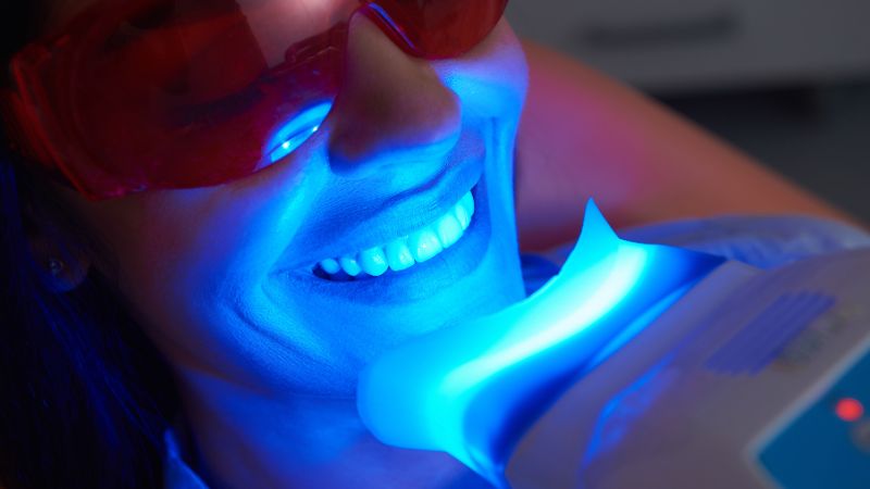 Blanqueamiento dental