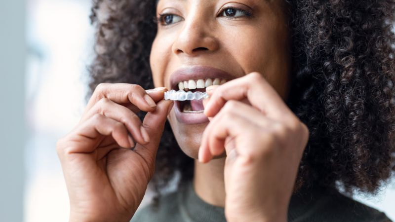 Ortodoncia invisible vs. brackets tradicionales