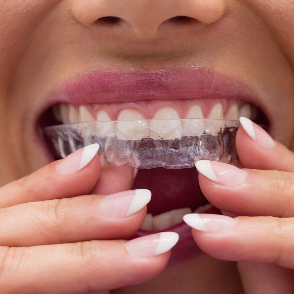 female patient wearing braces 1