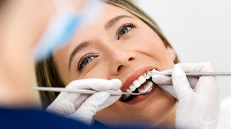 limpieza dental profesional