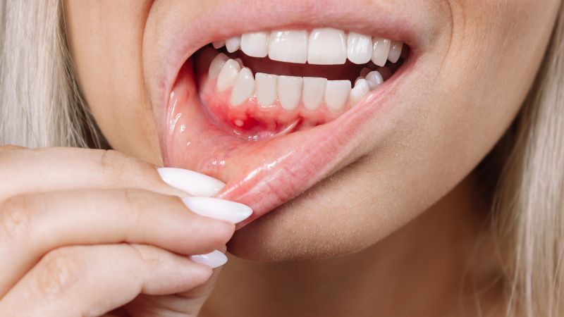 Periodoncia - Barberà del Vallès