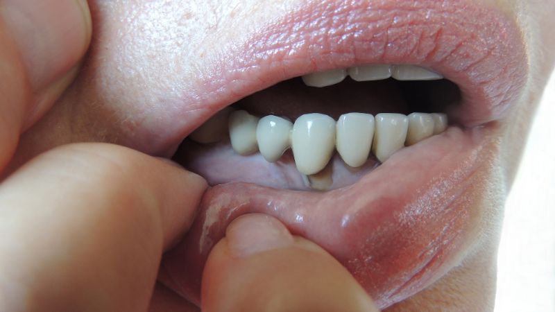 Periodoncia - Barberà del Vallès