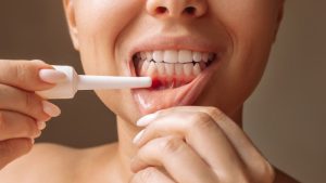 Periodoncia - Barberà del Vallès