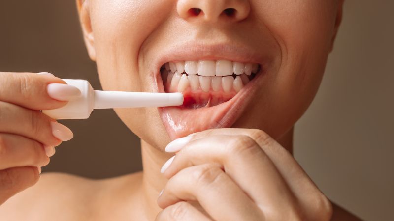 Periodoncia - Barberà del Vallès