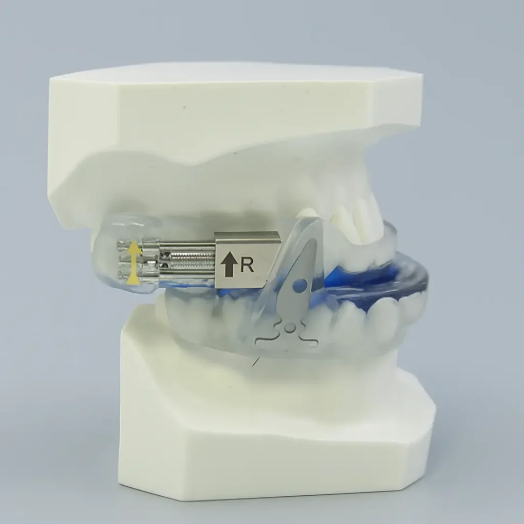 apnea tratamiento dental