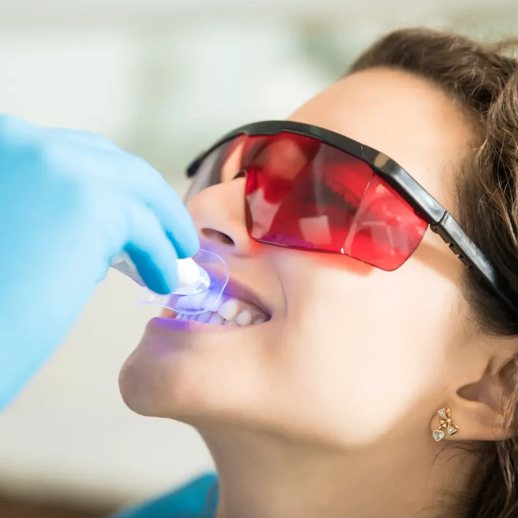 Quickwhite clinic esdental