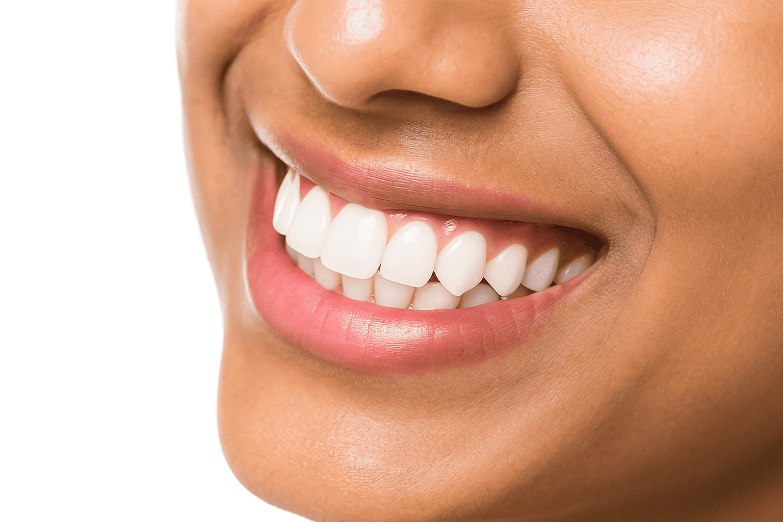 Resultados visibles del blanqueamiento dental profesional